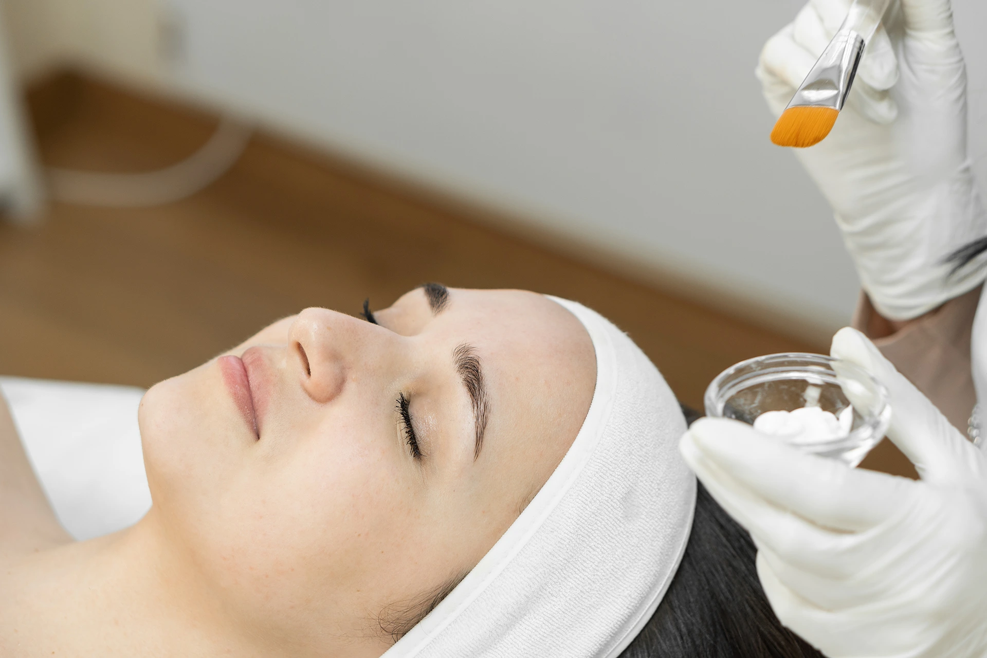 Burn Spots After Chemical Peel Treatment