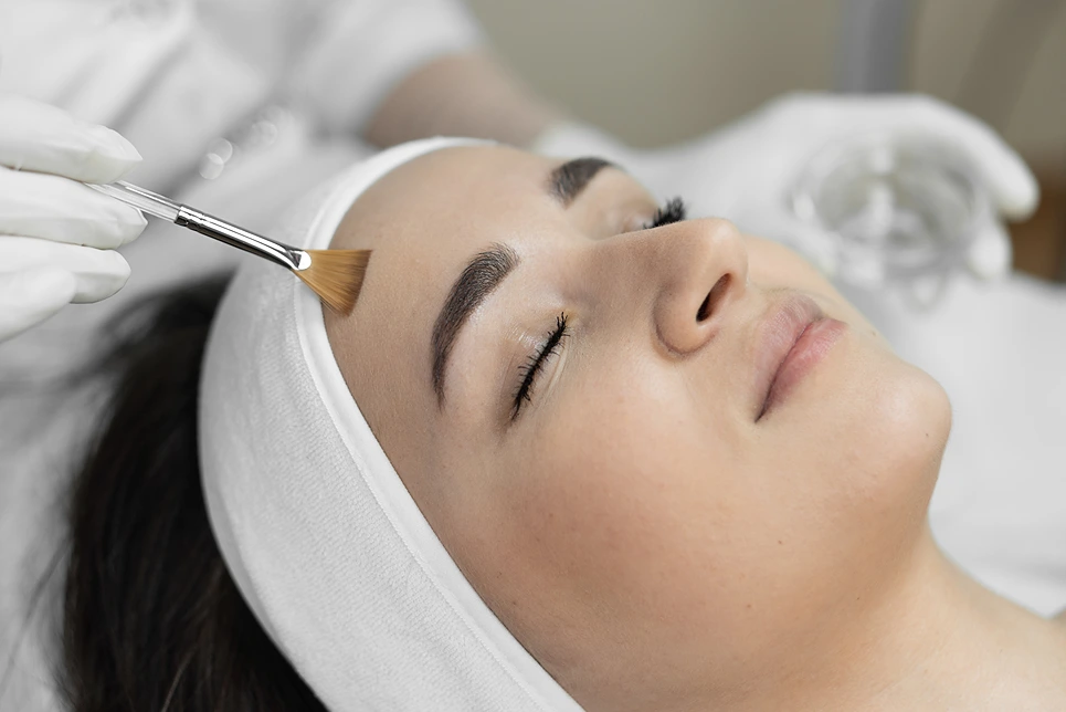 Burn Spots After Chemical Peel Treatment