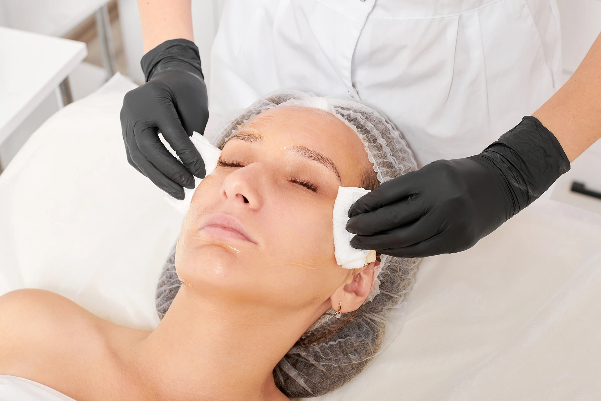Dermaplaning Aftercare: Expert Tips for Results