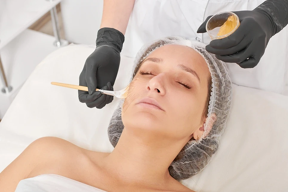 What to Expect During a Light Chemical Peel Procedure