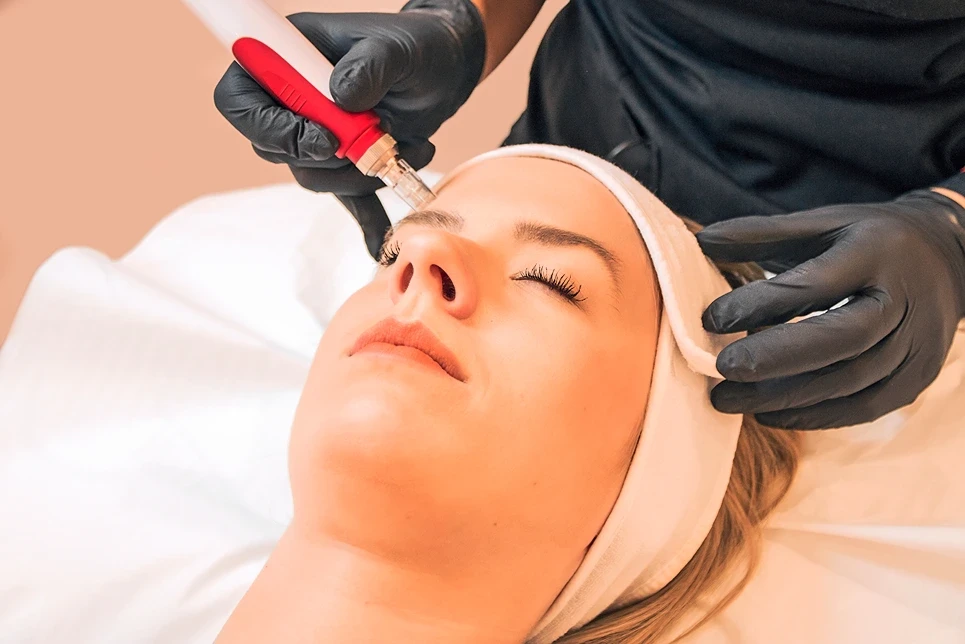 The Different Types of Chemical Peels: A Complete Guide