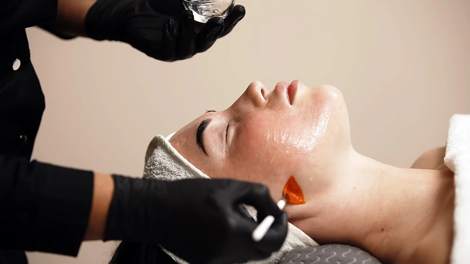 The Different Types of Chemical Peels: A Complete Guide