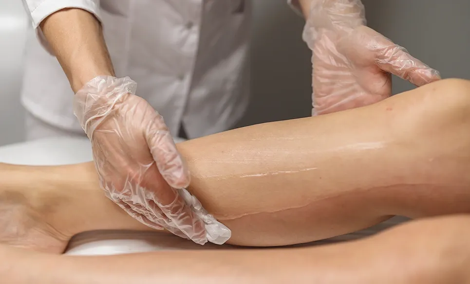 Chemical Peels on Legs: Before & After Guide