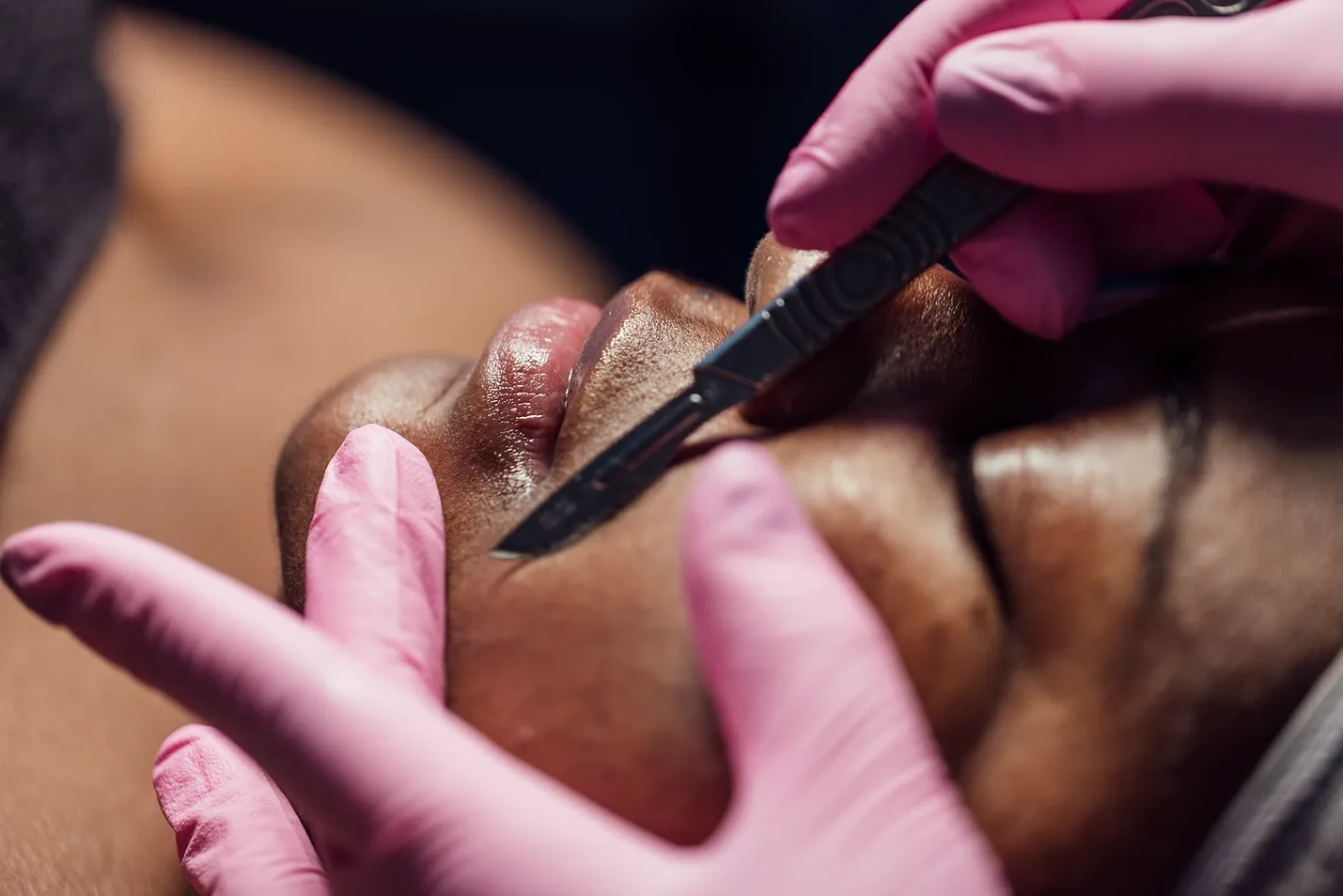 Dermablading vs Dermaplaning: The Ultimate Guide