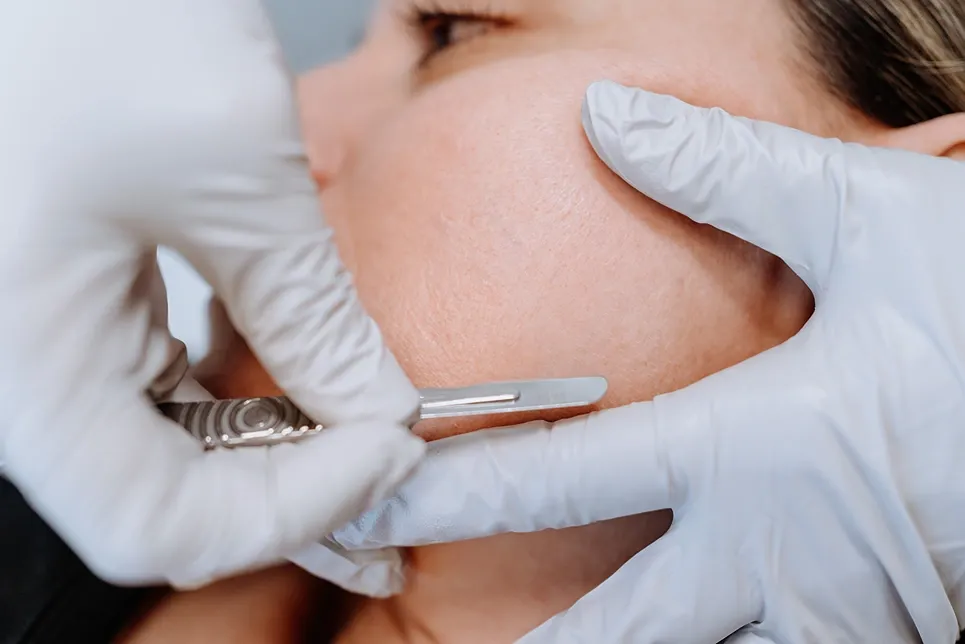 Dermablading vs Dermaplaning: The Ultimate Guide