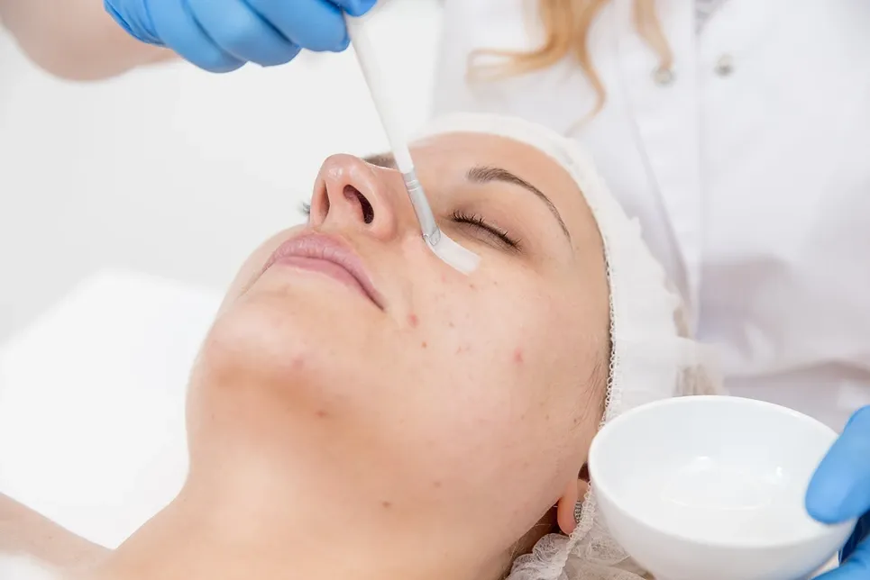 What to Expect During Your Enzyme Peel Facial