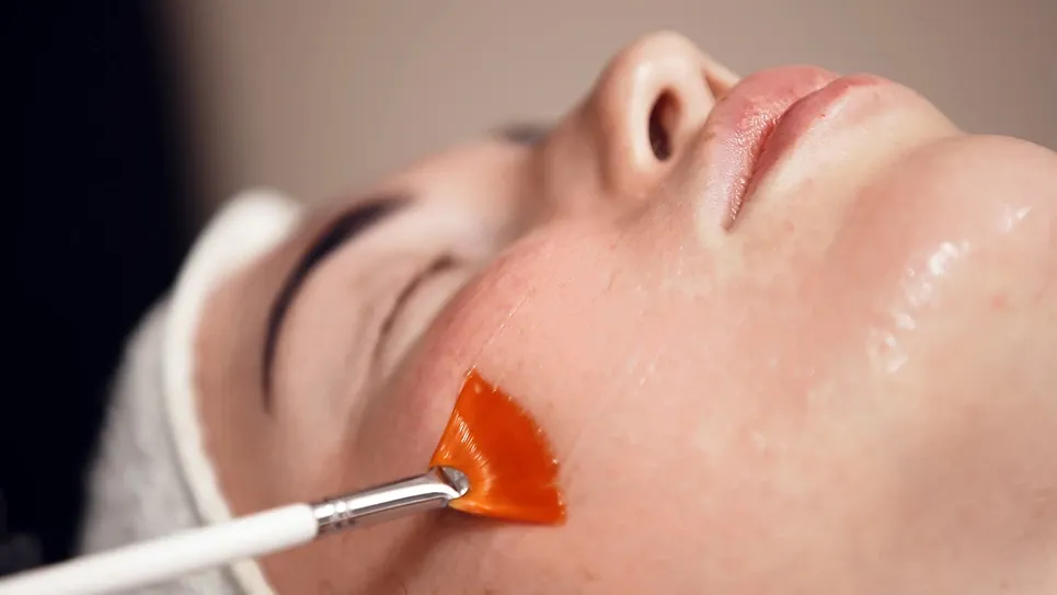 Chemical Peels for Sensitive Skin: A Gentle Guide