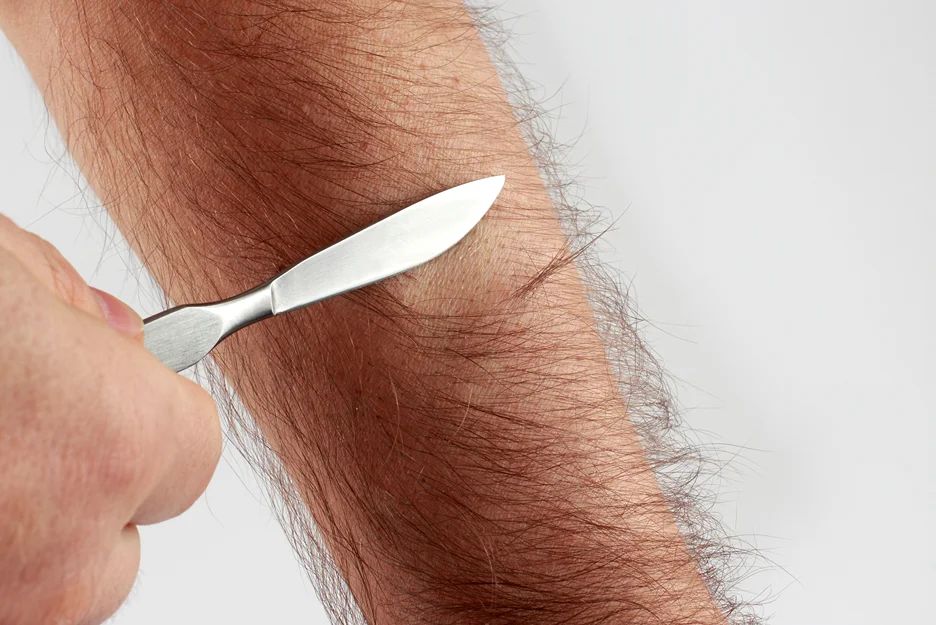 Why Dermaplane Your Arms? The Top Benefits