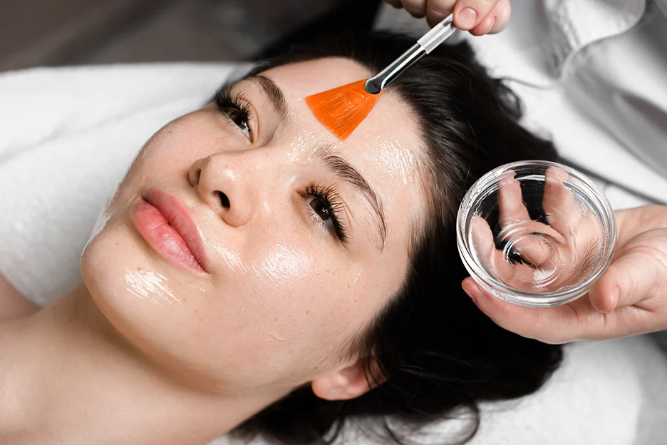 Chemical Peels: A Professional Solution for Blackheads