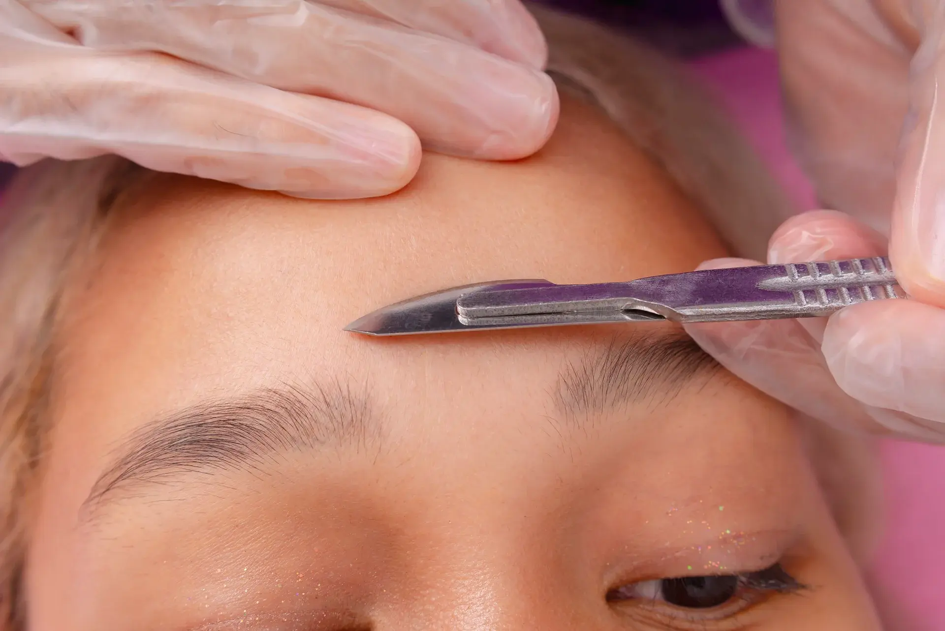 Dermaplaning vs Threading: Which Is Right for You?
