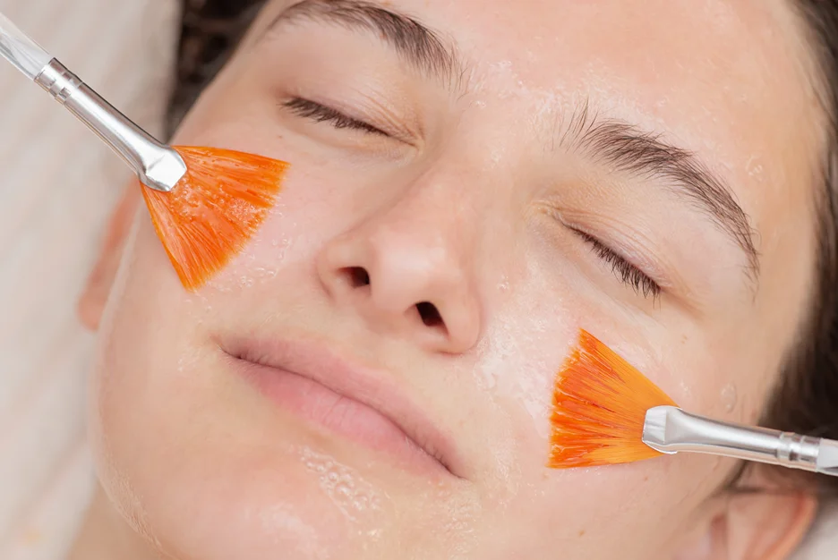 How Chemical Peels Work on Skin