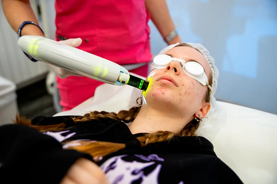 Clear Skin for the Classroom: Teen Acne Solutions in Dexter