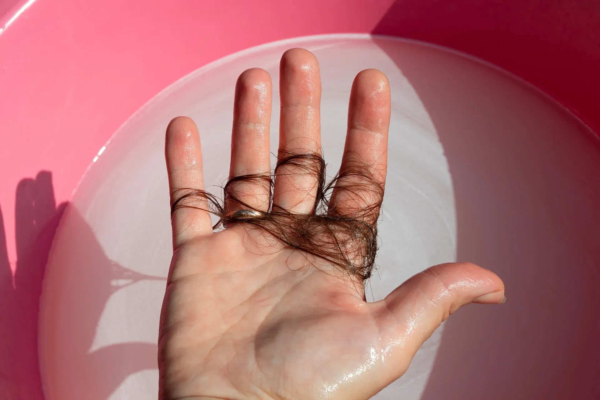 PRP Hair Restoration in Chelsea for the Holidays