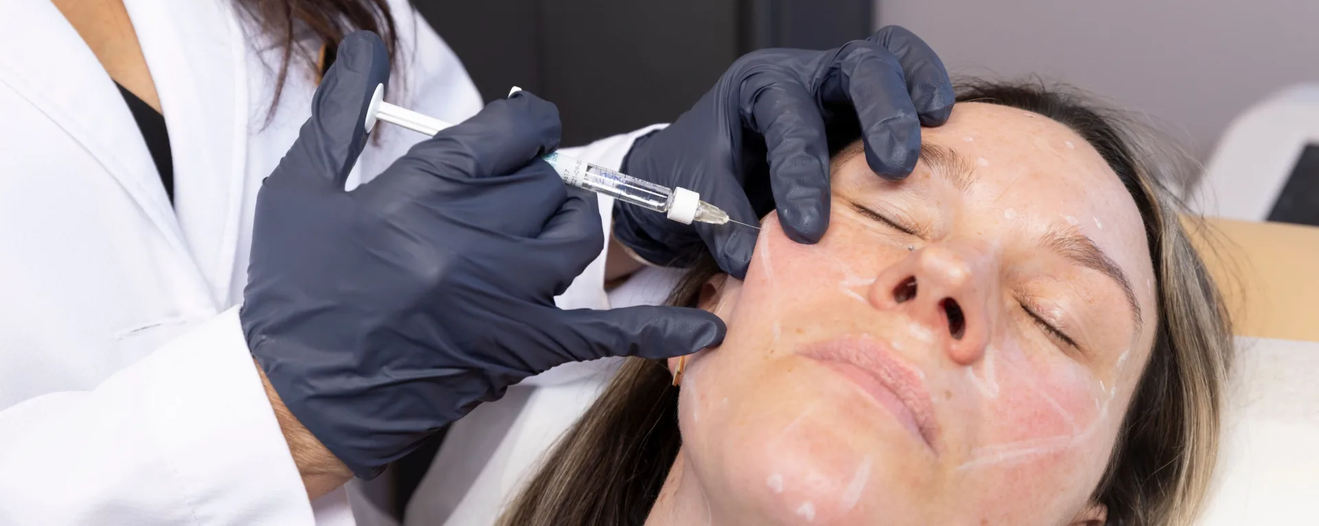 Liquid Facelift