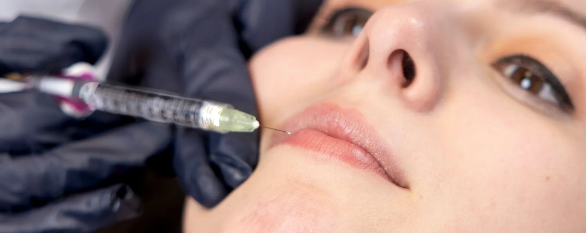 Dermal Fillers