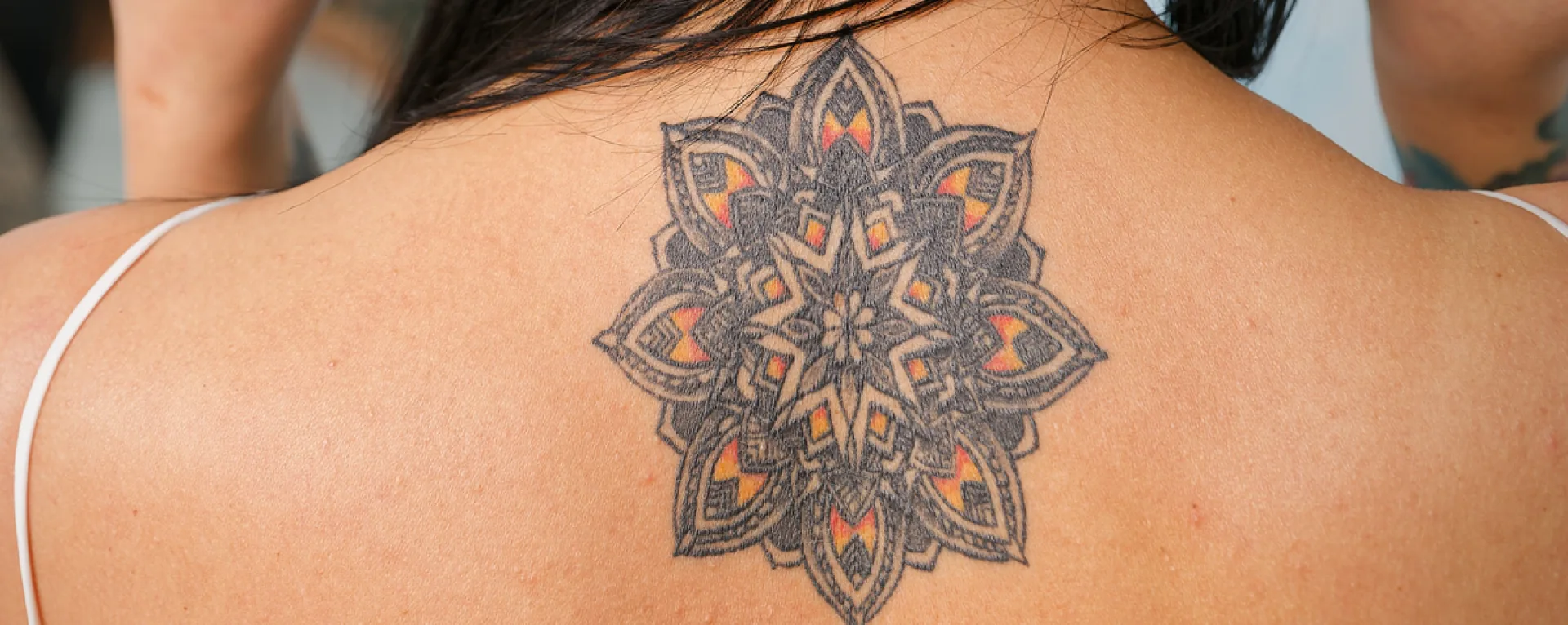 PicoLazer Tattoo Removal