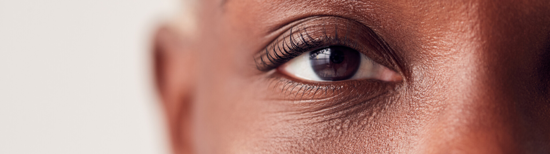 Eye Concerns