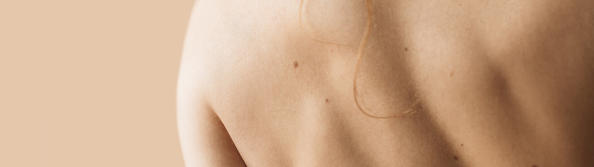 Skin Lesions