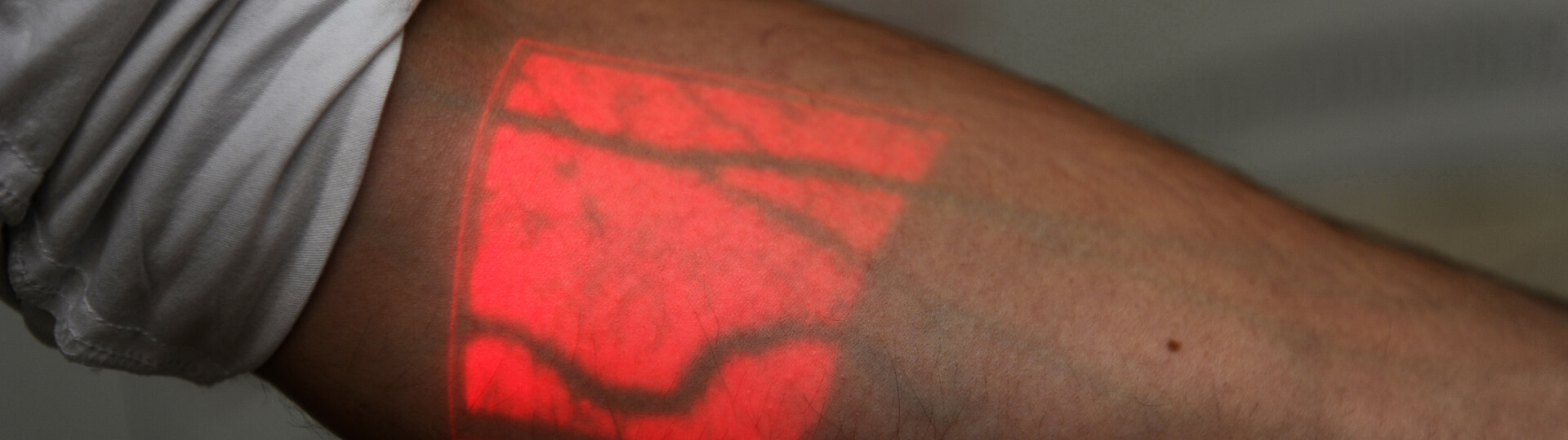 Vein Finder