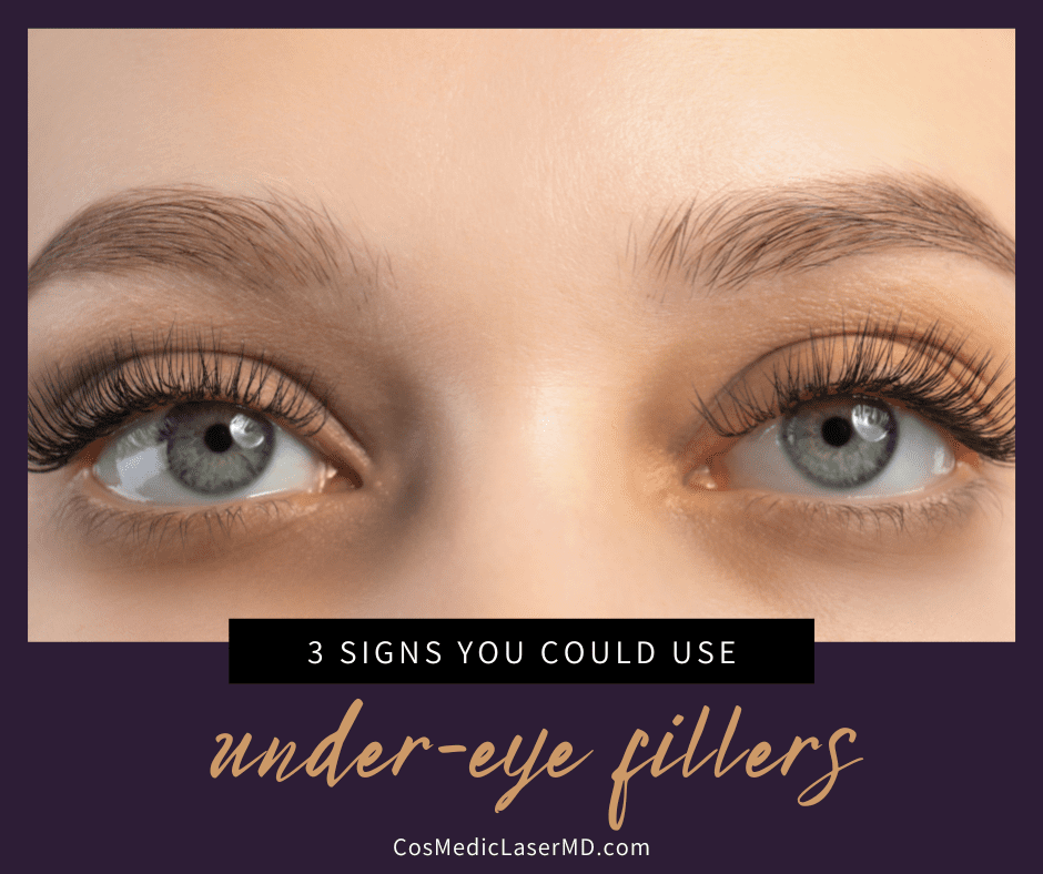 3 Signs You Could Use Under-Eye Filler