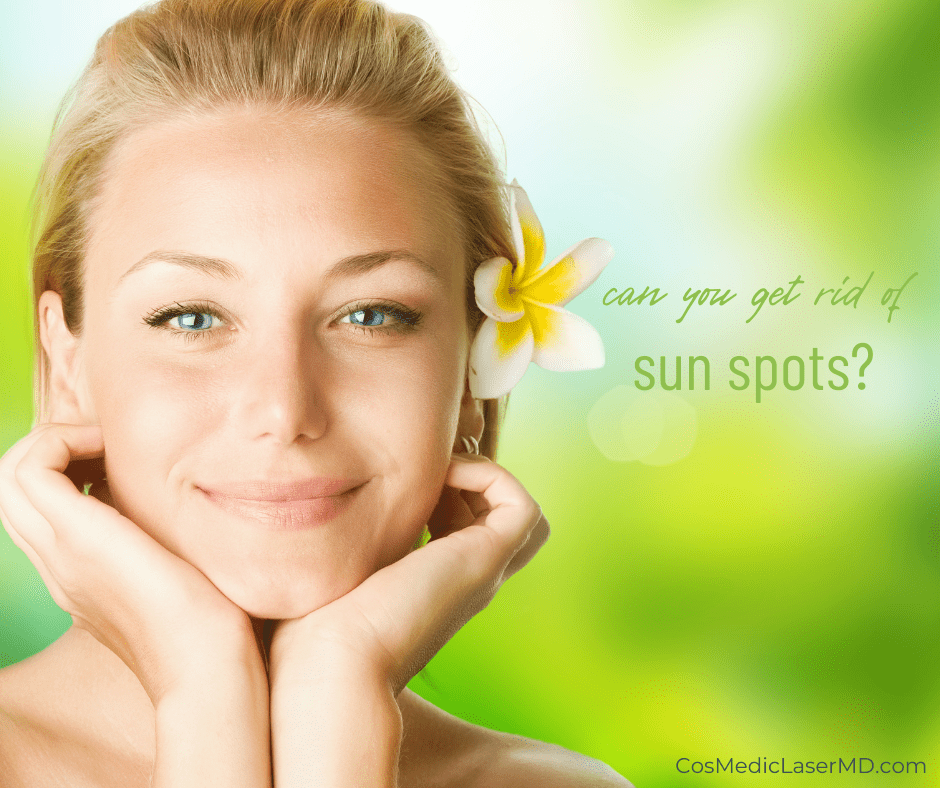 Can You Get Rid of Sun Spots?