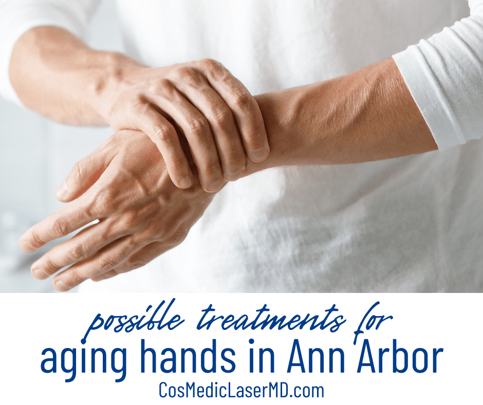 Hand Wrinkle Treatment in Ann Arbor