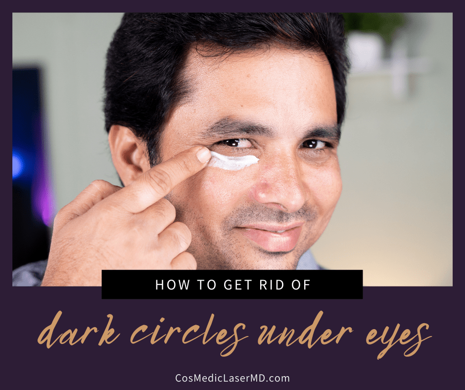 How to Get Rid of Dark Circles Under Eyes Without Surgery - Cosmetic Eye Treatments in Ann Arbor MI