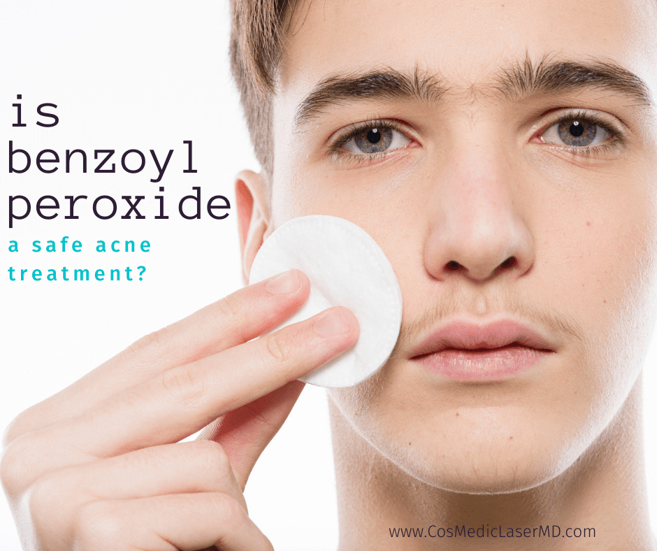 Is Benzoyl Peroxide a Safe Acne Treatment - Acne Treatment for Teens in Ann Arbor