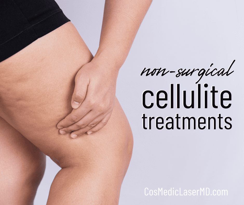 Non-Surgical Cellulite Treatments in Ann Arbor