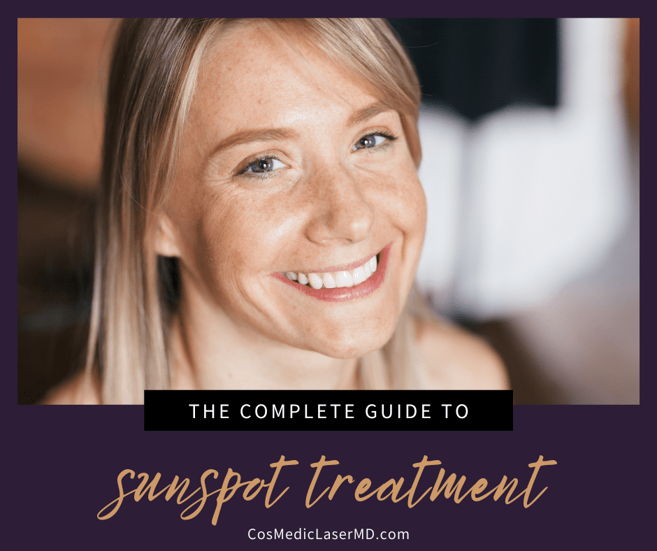 The Complete Guide to Sunspot Treatment in Ann Arbor