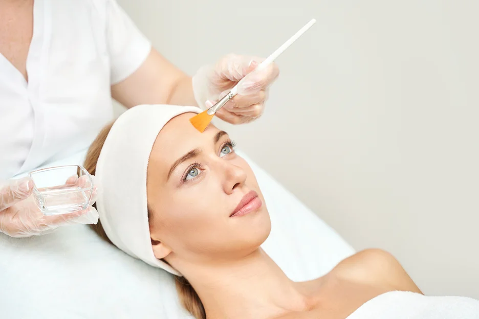 a woman received chemical peels treatment