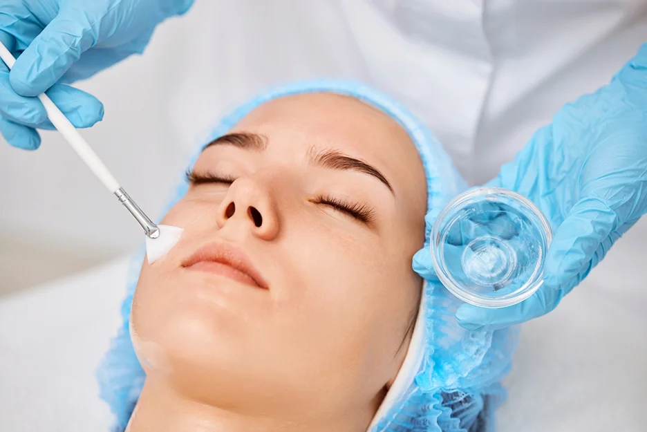 professional chemical peel