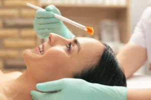 professional chemical peel